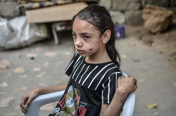 Foto - Filistinli kızın yürek yakan feryadı