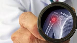 Foto - Yorgunluk ve unutkanlığınızın nedeni bu olabilir: Her şey dahil! İşte vitamin eksikliğinin 10 işareti var