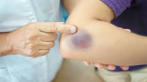 Foto - Yorgunluk ve unutkanlığınızın nedeni bu olabilir: Her şey dahil! İşte vitamin eksikliğinin 10 işareti var