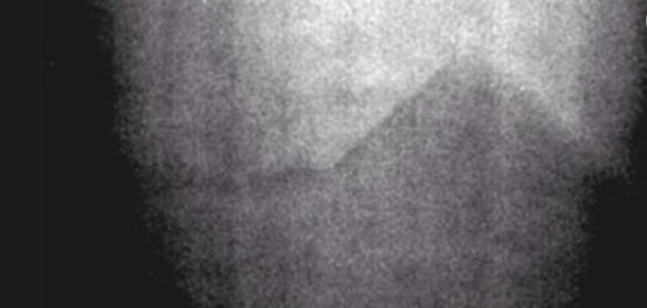 Foto - Fotoğraftaki detay kan dondurdu! Bilim dünyası açıklama yapamıyor