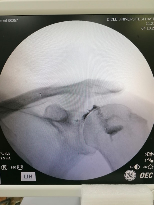 Foto - Fransa'da kapı kapı dolaştı! Olmayınca şifayı Diyarbakır'da buldu