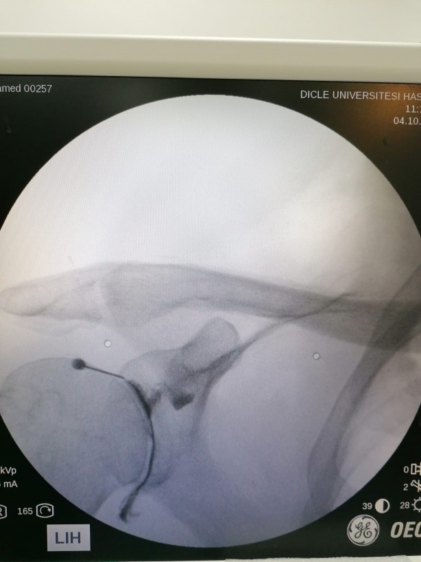 Foto - Fransa'da kapı kapı dolaştı! Olmayınca şifayı Diyarbakır'da buldu