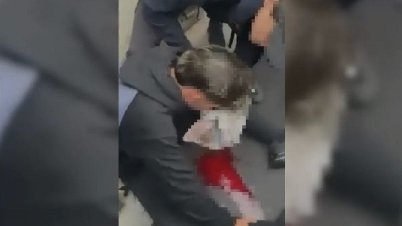 Foto - Fransa’daki olaylarda plastik mermi ile vurulmuştu! Polisin kör ettiği genç yargıya koştu