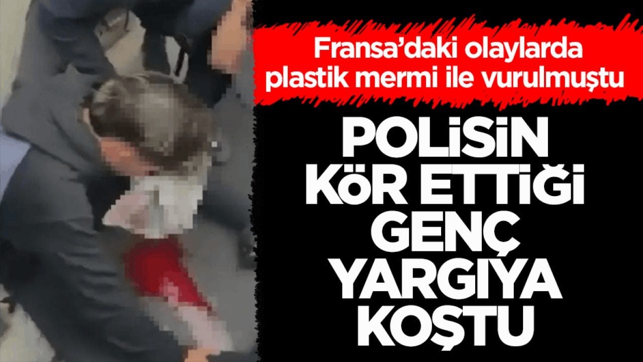 Fransa’daki olaylarda plastik mermi ile vurulmuştu! Polisin kör ettiği genç yargıya koştu