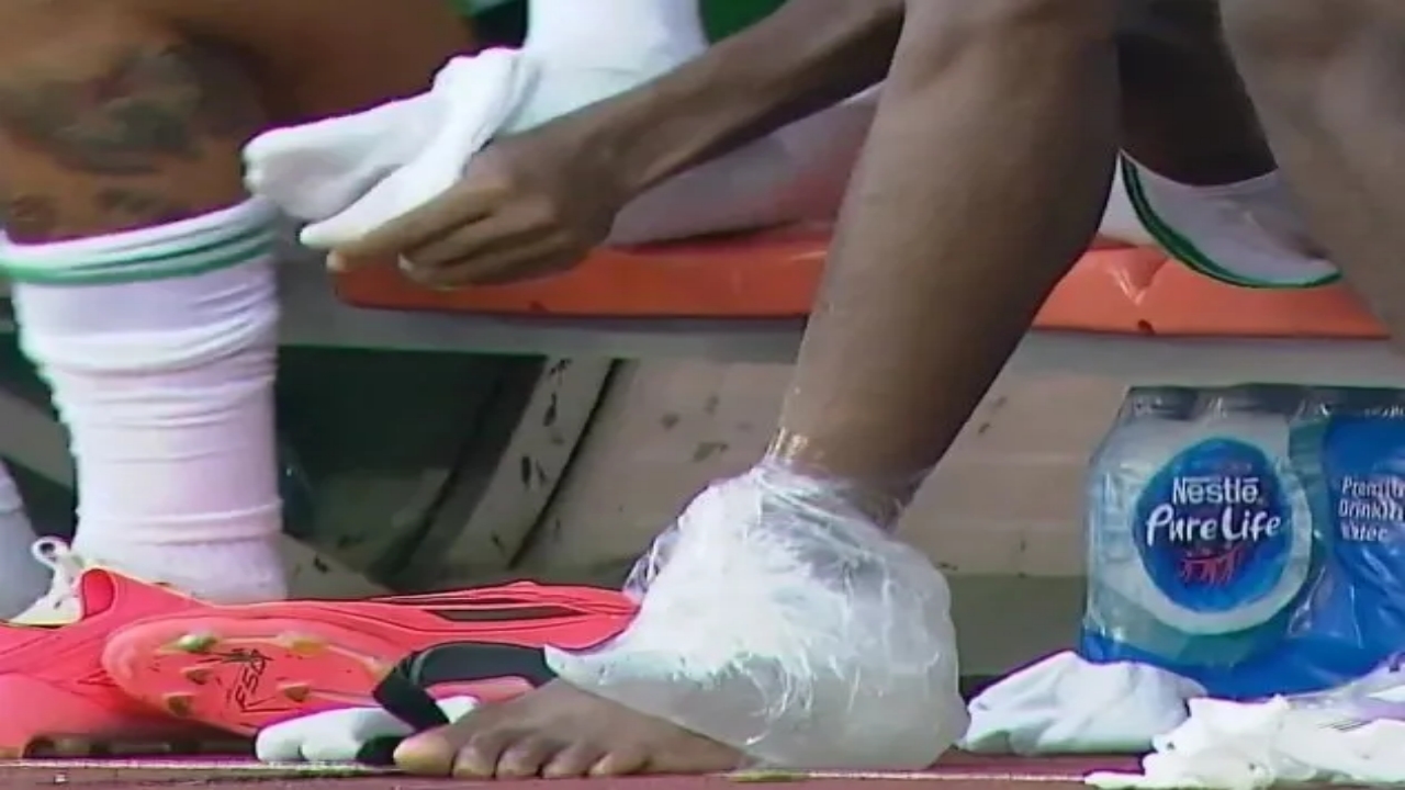 Foto - Galatasaray’a "Osimhen" şoku! Taraftarlar kahroldu