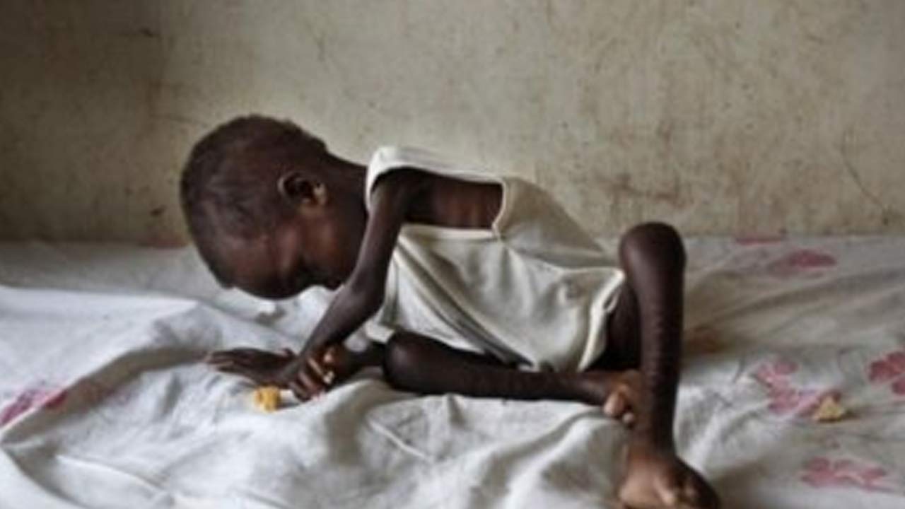 Gazze gibi Sudan da yalnız bırakıldı… Bir ayda 23 çocuk açlıktan öldü