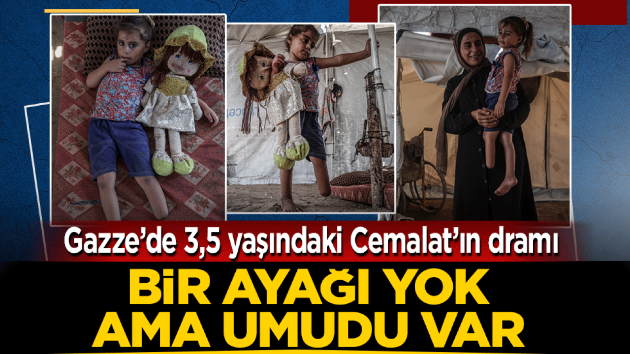 Gazze’de 3,5 yaşındaki Cemalat’ın dramı! Bir ayağı yok ama umumdu var 