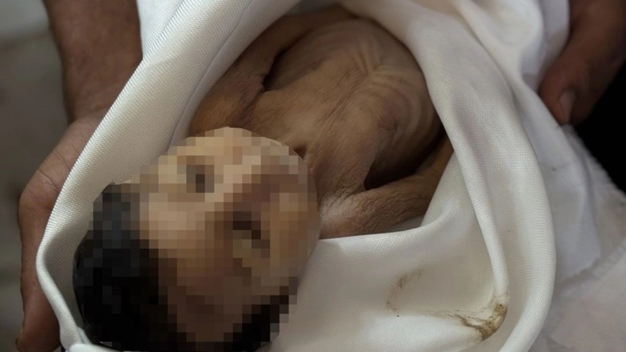 Foto - Gazze'de 5 aylık bir bebek açlıktan şehid oldu! Müslümanlar kıyameti koparması gerekirken suskun...