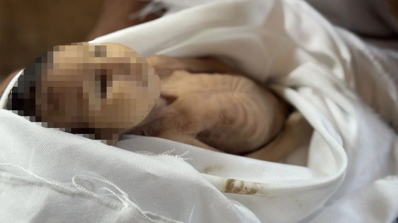 Gazze'de 5 aylık bir bebek açlıktan şehid oldu! Müslümanlar kıyameti koparması gerekirken suskun...