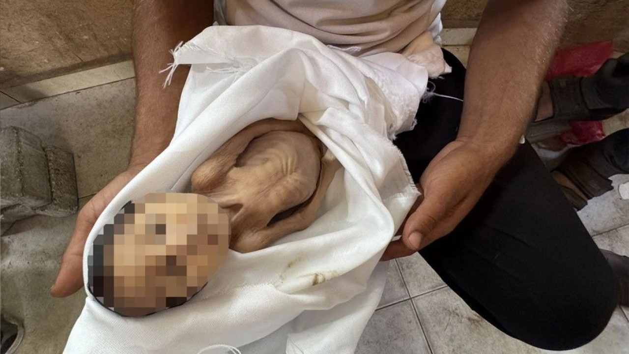 Foto - Gazze'de 5 aylık bir bebek açlıktan şehid oldu! Müslümanlar kıyameti koparması gerekirken suskun...
