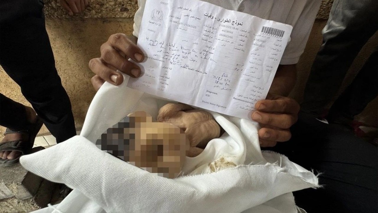 Foto - Gazze'de 5 aylık bir bebek açlıktan şehid oldu! Müslümanlar kıyameti koparması gerekirken suskun...
