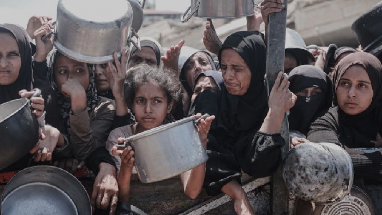 Foto - Gazze'de açlıktan ölenlerin sayısı artıyor