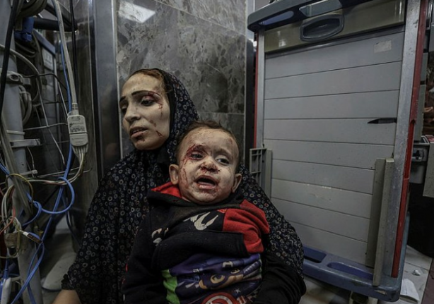 Foto - Gazze'de artık söz bitti! Dünya daha neyi bekliyor! Savaş suçu, soykırım, katliam