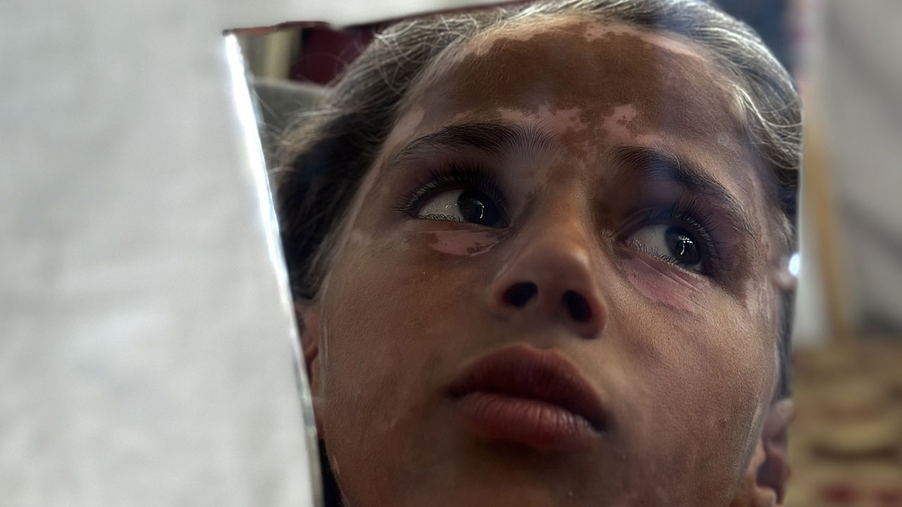 Foto - Gazze'de çocuk olmak! 10 yaşındaki Lana'nın saçları ağardı