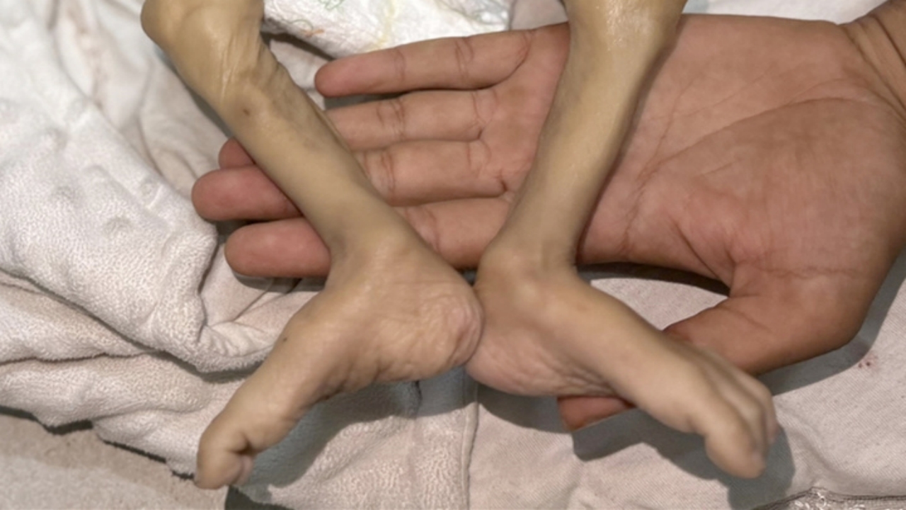 Foto - Gazze’de insanlığımızdan utandıracak görüntü! Yüreğiniz el veriyorsa, tıklayın da şu fotoğraflara bakın