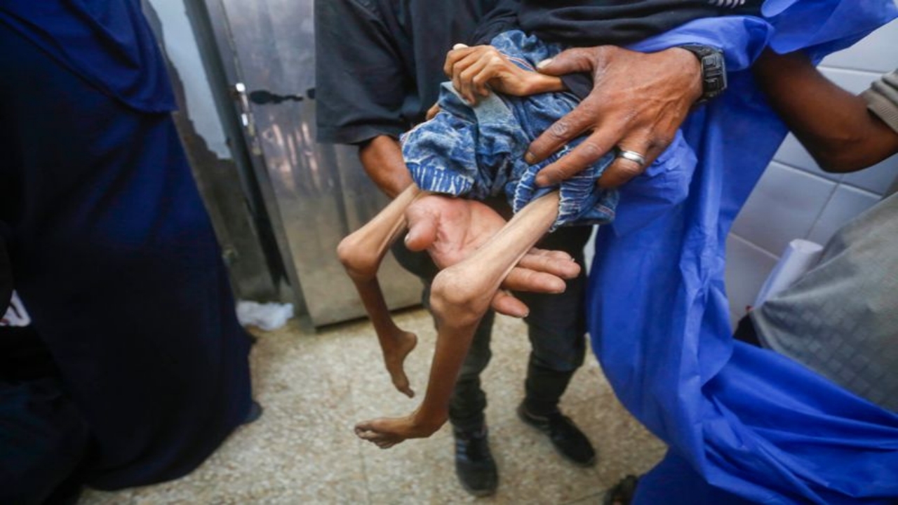 Foto - Gazze’de insanlığımızdan utandıracak görüntü! Yüreğiniz el veriyorsa, tıklayın da şu fotoğraflara bakın