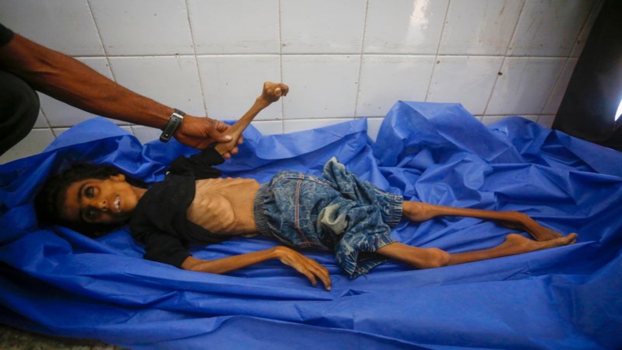 Foto - Gazze’de insanlığımızdan utandıracak görüntü! Yüreğiniz el veriyorsa, tıklayın da şu fotoğraflara bakın