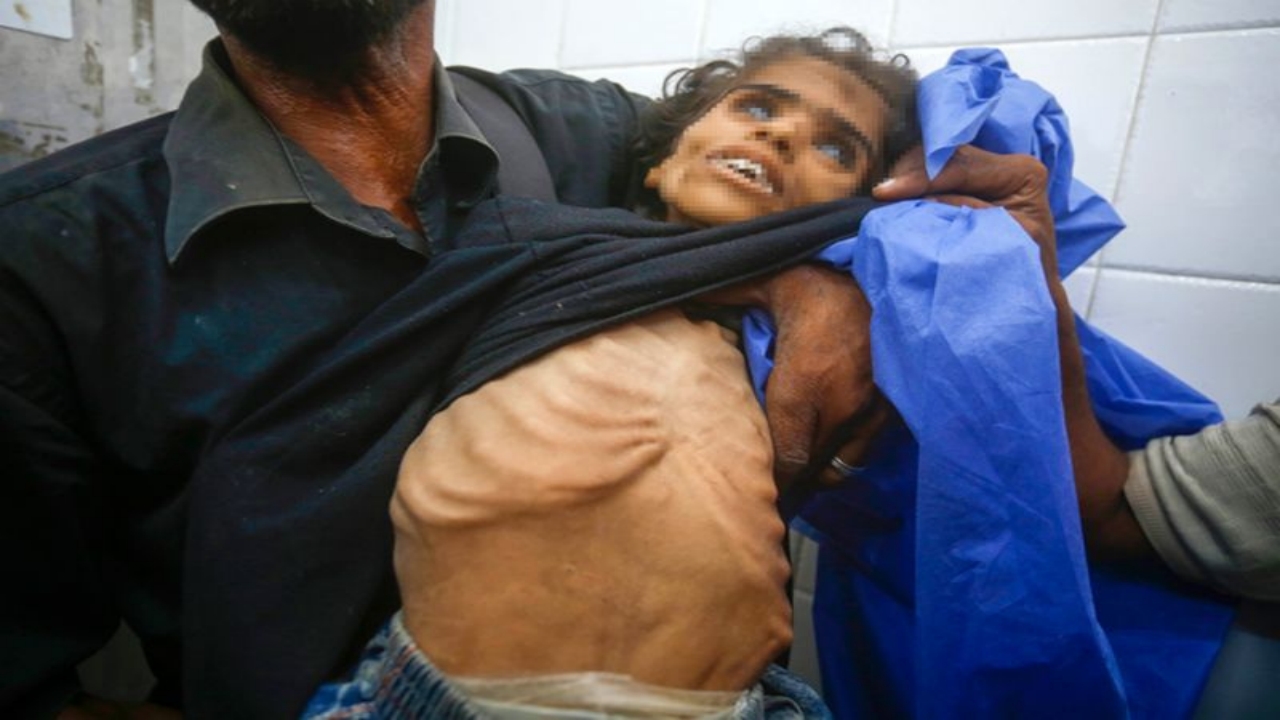 Gazze’de insanlığımızdan utandıracak görüntü! Yüreğiniz el veriyorsa, tıklayın da şu fotoğraflara bakın