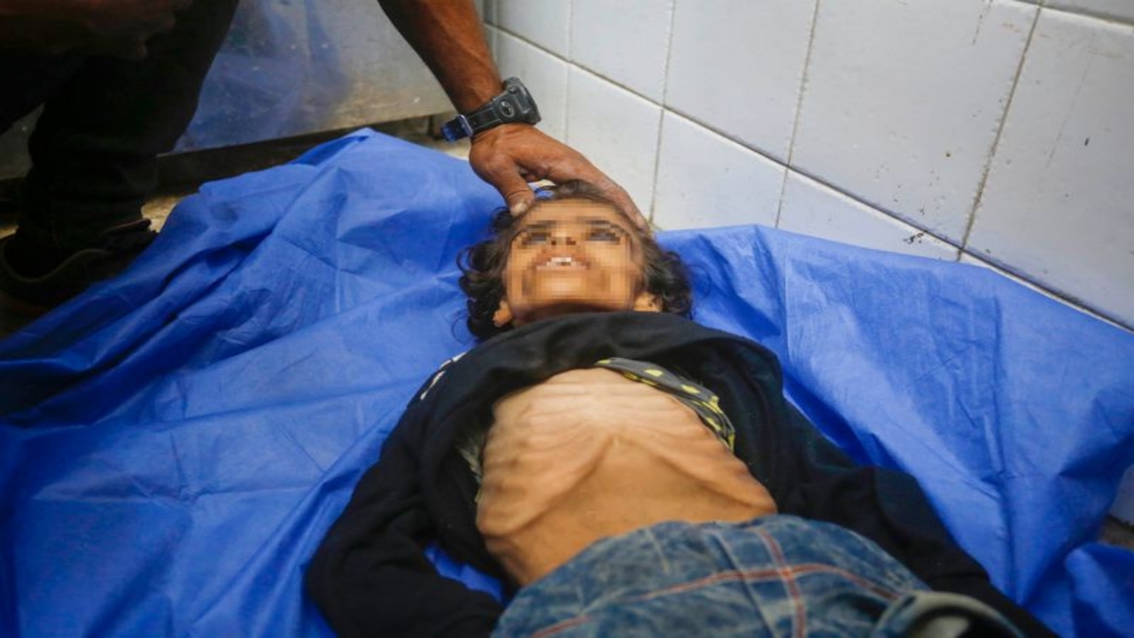 Foto - Gazze’de insanlığımızdan utandıracak görüntü! Yüreğiniz el veriyorsa, tıklayın da şu fotoğraflara bakın