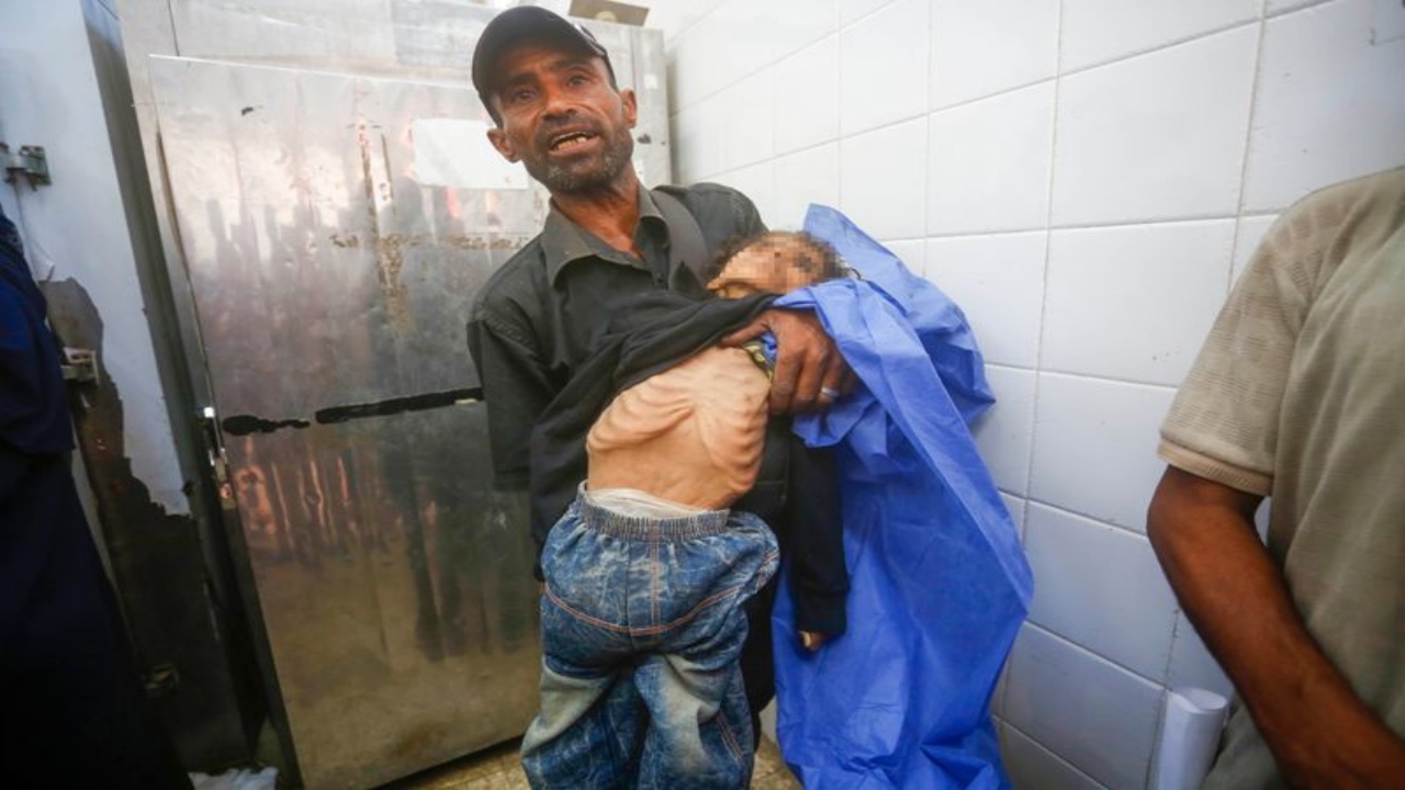 Foto - Gazze’de insanlığımızdan utandıracak görüntü! Yüreğiniz el veriyorsa, tıklayın da şu fotoğraflara bakın