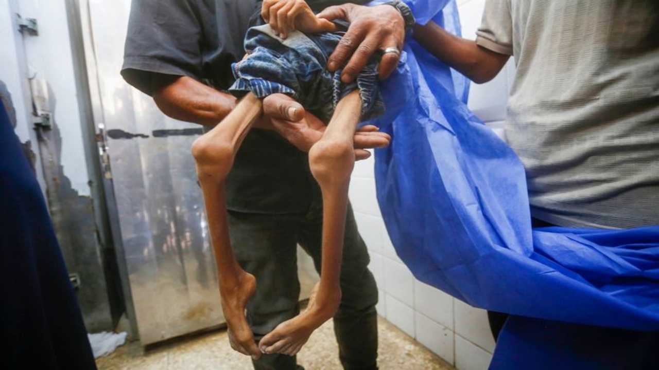 Foto - Gazze’de insanlığımızdan utandıracak görüntü! Yüreğiniz el veriyorsa, tıklayın da şu fotoğraflara bakın