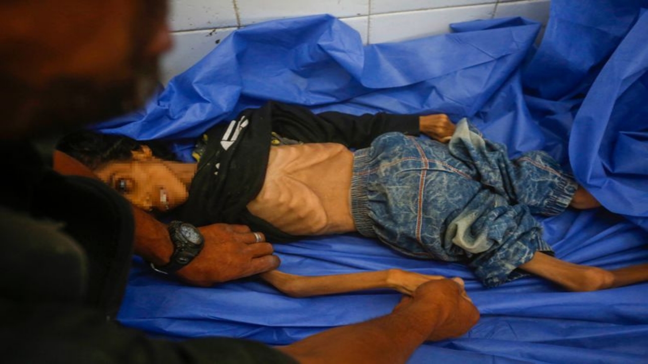 Foto - Gazze’de insanlığımızdan utandıracak görüntü! Yüreğiniz el veriyorsa, tıklayın da şu fotoğraflara bakın