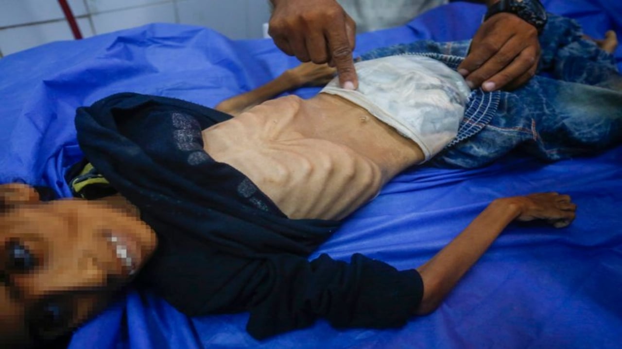 Foto - Gazze’de insanlığımızdan utandıracak görüntü! Yüreğiniz el veriyorsa, tıklayın da şu fotoğraflara bakın