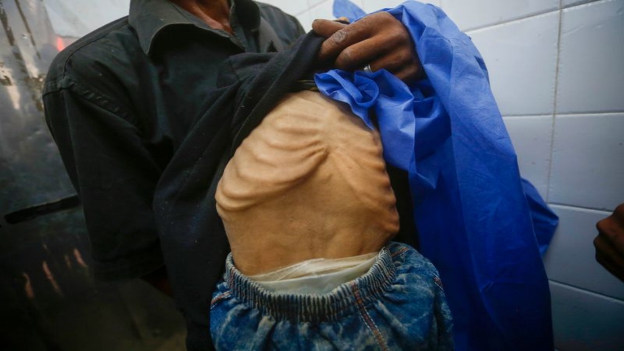 Foto - Gazze’de insanlığımızdan utandıracak görüntü! Yüreğiniz el veriyorsa, tıklayın da şu fotoğraflara bakın