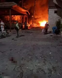 Foto - Gazze’de insanlığın utandığı nokta! Çocuklar ölümü böyle bekliyor