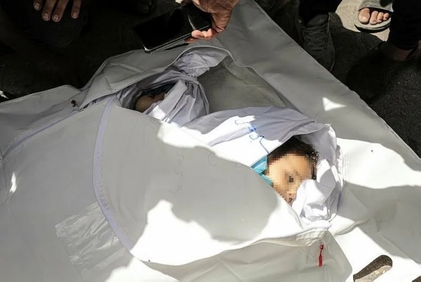 Foto - Gazze'de kanlı sabah! Katil İsrail öldürmeye devam ediyor: Her yer Filistinli çocukların cesetleriyle dolu