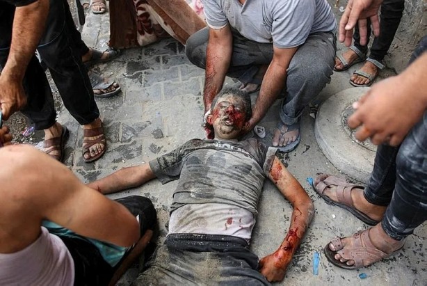 Foto - Gazze'de kanlı sabah! Katil İsrail öldürmeye devam ediyor: Her yer Filistinli çocukların cesetleriyle dolu