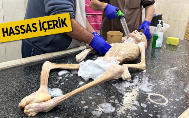 Gazze'de yetersiz beslenme sonucu ölen 10 yaşındaki Filistinli çocuktan geriye bu fotoğraflar kaldı! İşte "Allah bu İsrail’in tez zamanda belasını versin" dedirten kareler