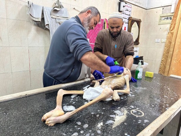 Foto - Gazze'de yetersiz beslenme sonucu ölen 10 yaşındaki Filistinli çocuktan geriye bu fotoğraflar kaldı! İşte "Allah bu İsrail’in tez zamanda belasını versin" dedirten kareler