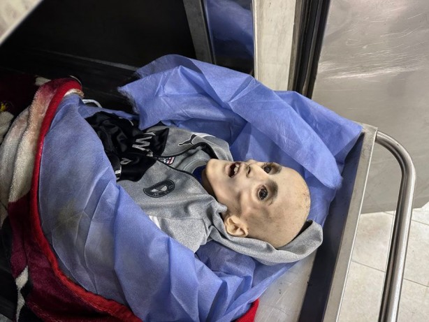 Foto - Gazze'de yetersiz beslenme sonucu ölen 10 yaşındaki Filistinli çocuktan geriye bu fotoğraflar kaldı! İşte "Allah bu İsrail’in tez zamanda belasını versin" dedirten kareler