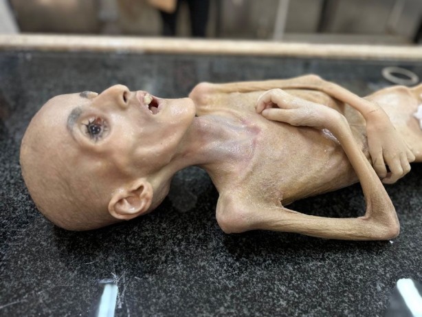 Foto - Gazze'de yetersiz beslenme sonucu ölen 10 yaşındaki Filistinli çocuktan geriye bu fotoğraflar kaldı! İşte "Allah bu İsrail’in tez zamanda belasını versin" dedirten kareler