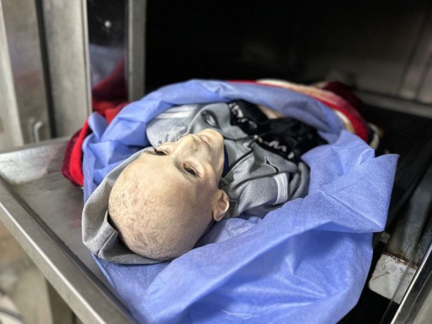 Foto - Gazze'de yetersiz beslenme sonucu ölen 10 yaşındaki Filistinli çocuktan geriye bu fotoğraflar kaldı! İşte "Allah bu İsrail’in tez zamanda belasını versin" dedirten kareler