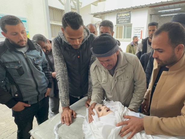 Foto - Gazze'de yetersiz beslenme sonucu ölen 10 yaşındaki Filistinli çocuktan geriye bu fotoğraflar kaldı! İşte "Allah bu İsrail’in tez zamanda belasını versin" dedirten kareler