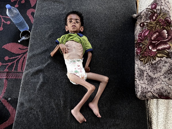 Foto - Gazze'den yürekleri parçalayan görüntü