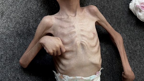 Foto - Gazze'den yürekleri parçalayan görüntü