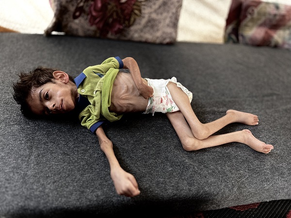 Foto - Gazze'den yürekleri parçalayan görüntü