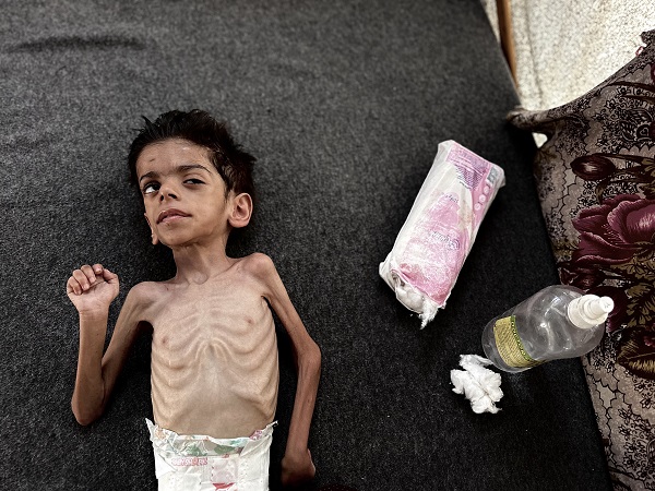 Foto - Gazze'den yürekleri parçalayan görüntü