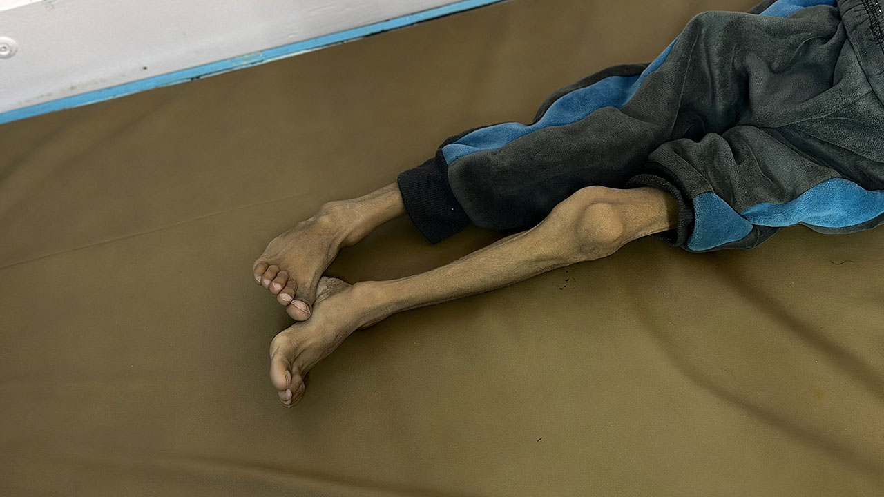 Foto - Gazzeli çocuklar açlıkla boğuşuyor