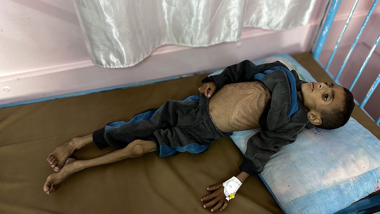 Foto - Gazzeli çocuklar açlıkla boğuşuyor