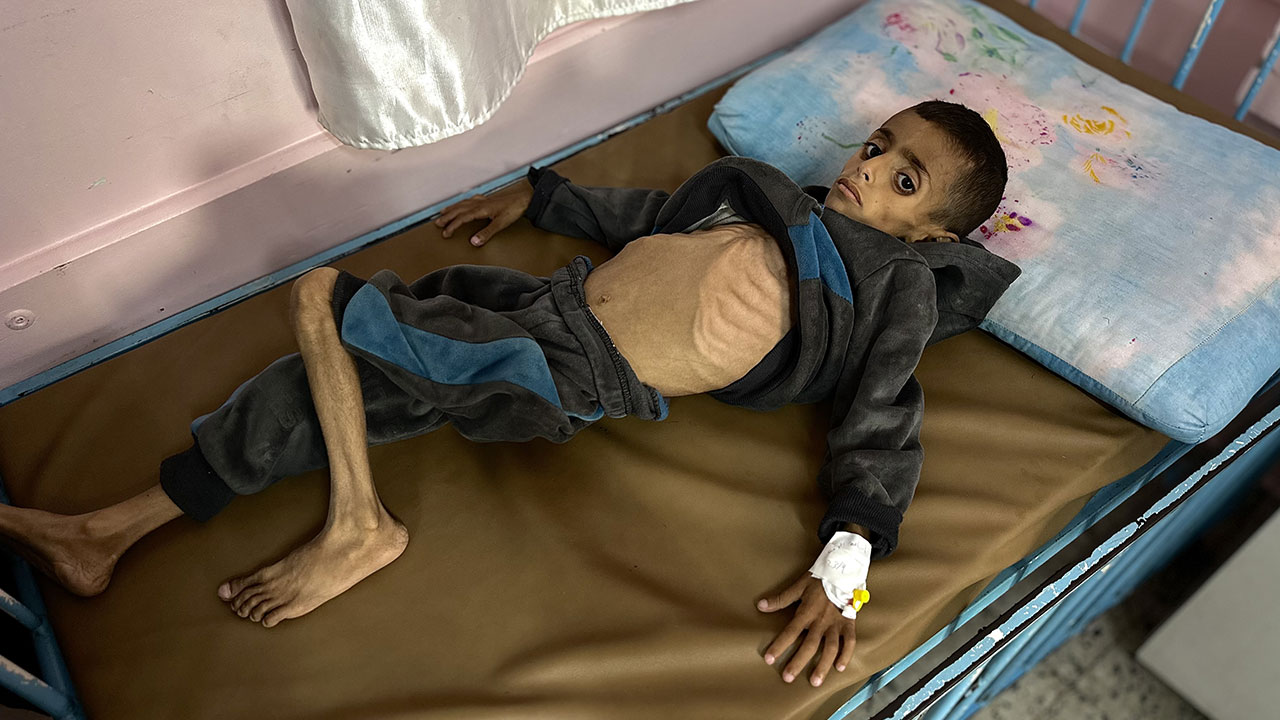 Foto - Gazzeli çocuklar açlıkla boğuşuyor