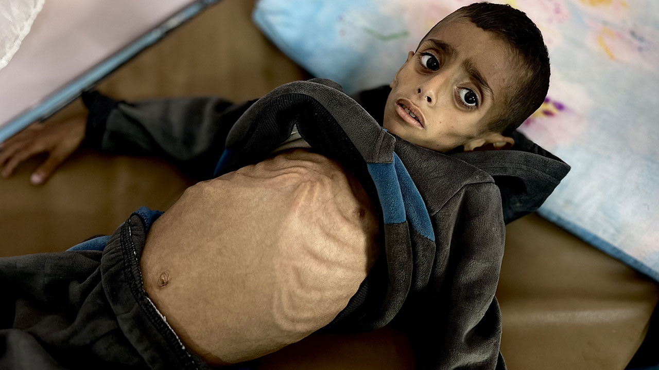 Foto - Gazzeli çocuklar açlıkla boğuşuyor