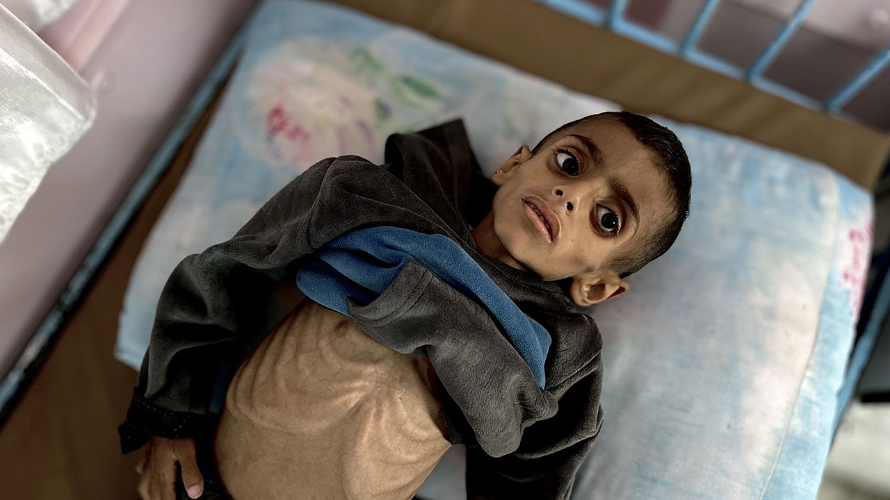 Foto - Gazzeli çocuklar açlıkla boğuşuyor