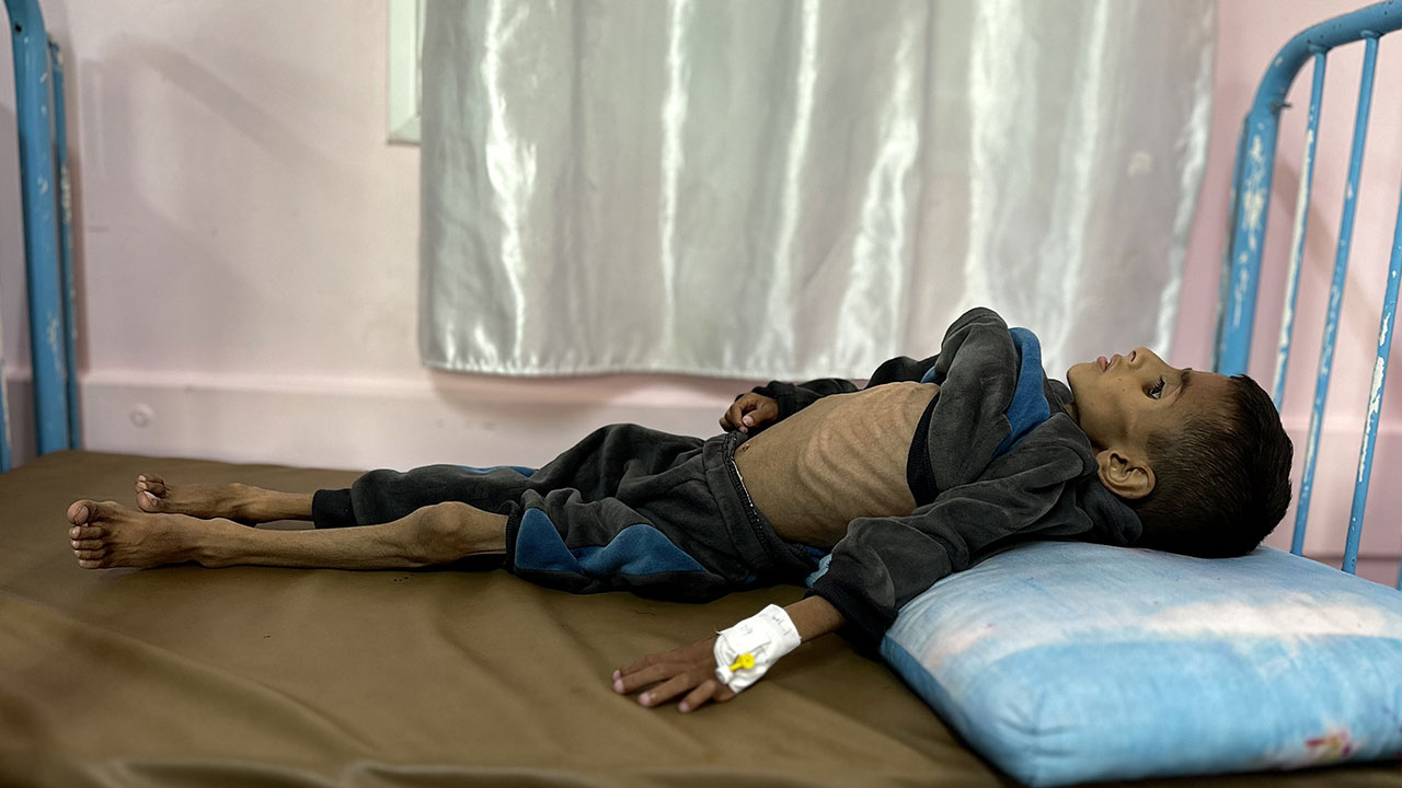 Foto - Gazzeli çocuklar açlıkla boğuşuyor