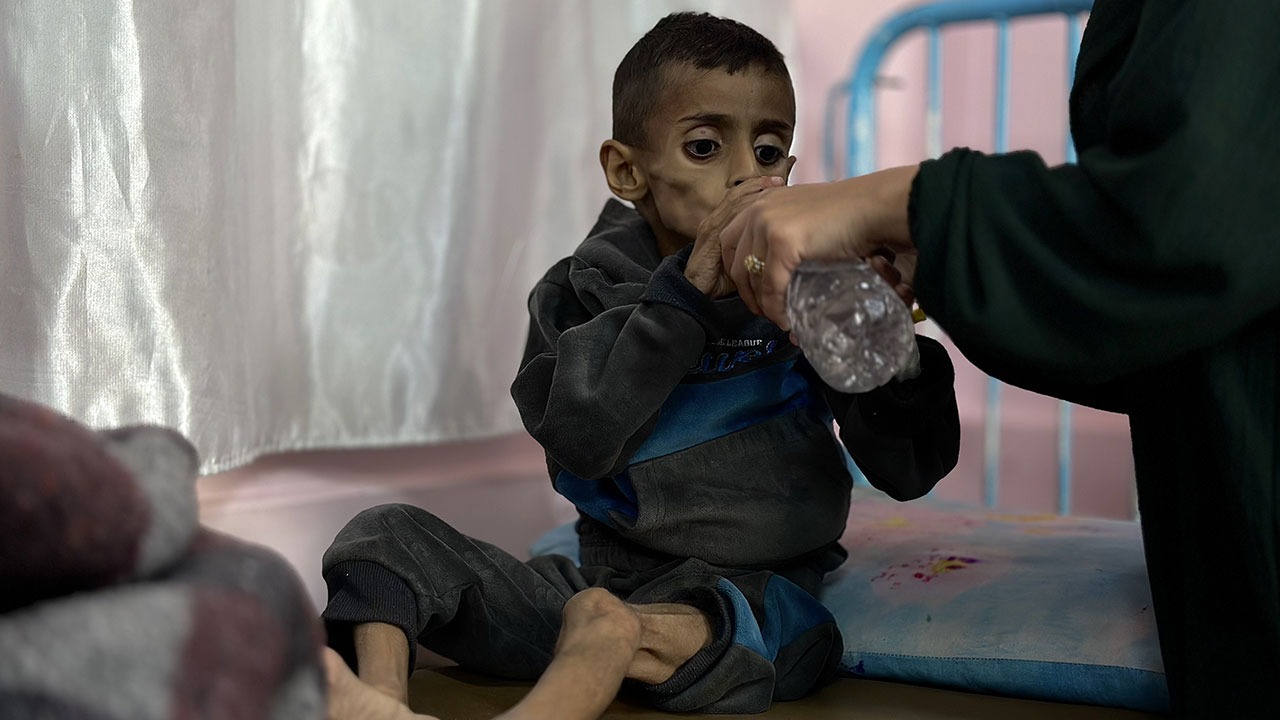 Foto - Gazzeli çocuklar açlıkla boğuşuyor