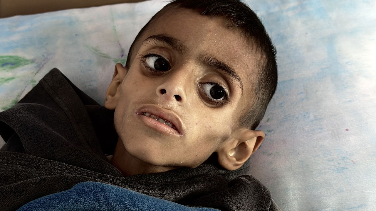 Foto - Gazzeli çocuklar açlıkla boğuşuyor