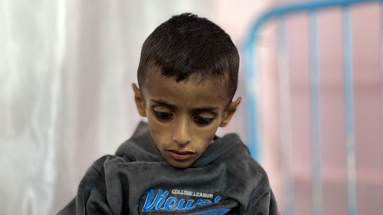 Foto - Gazzeli çocuklar açlıkla boğuşuyor